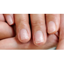 При ламких нігтях