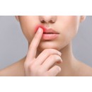 При герпесі