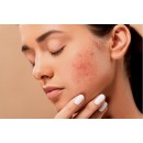 При проблемах зі шкірою